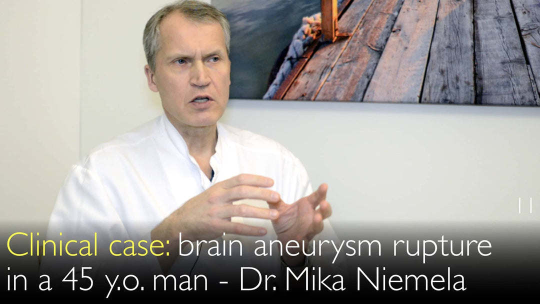 临床病例摘要 
 
 
 
 临床病例:脑动脉瘤破裂 
 
 患者信息: 男性,45岁 
 主诉: 突发剧烈头痛伴意识障碍 
 诊断: 脑动脉瘤破裂 
 治疗: 急诊行血管内介入栓塞术,术后重症监护 
 现状: 病情稳定,继续神经功能康复治疗